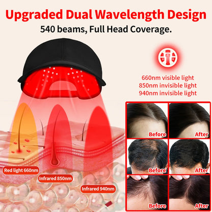 RED LIGHT THERAPY HERO CAP 180 PCs